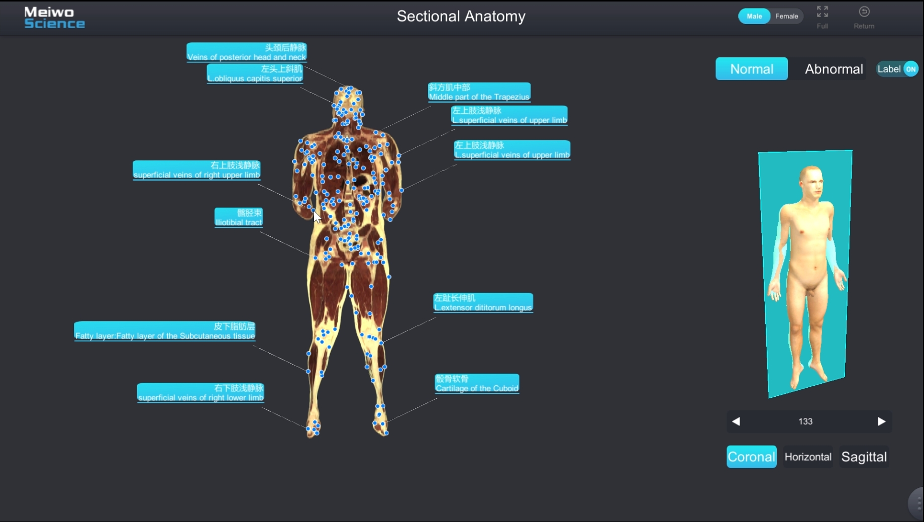 3d sectional anatomy