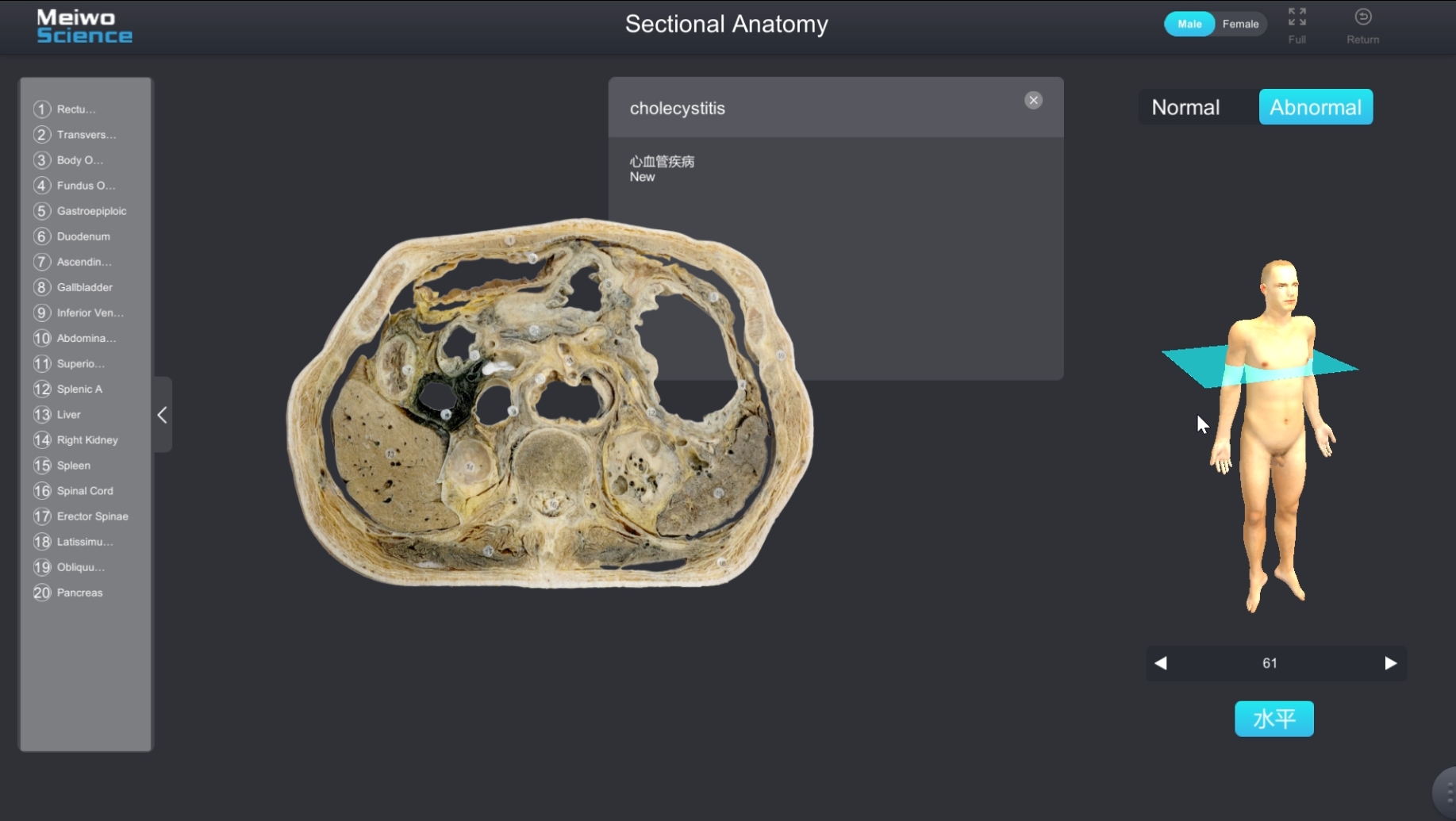 pathological sectional anatomy