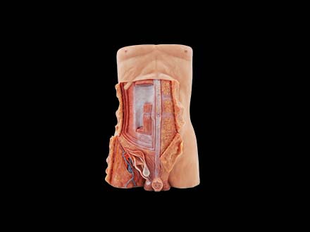 Anterior Abdominal Wall and Inguinal Hernia Soft Anatomy Model