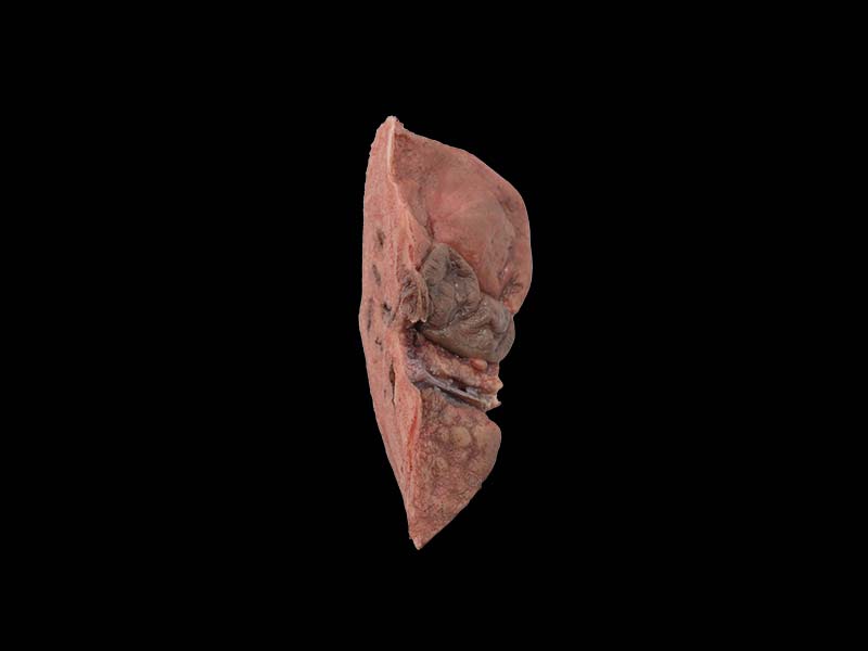 Pathlogy Liver Anatomy Model for sale