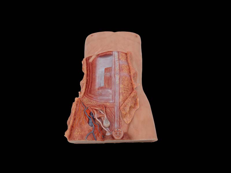 Anterior Abdominal Wall and Inguinal Hernia Anatomy Model for Sale
