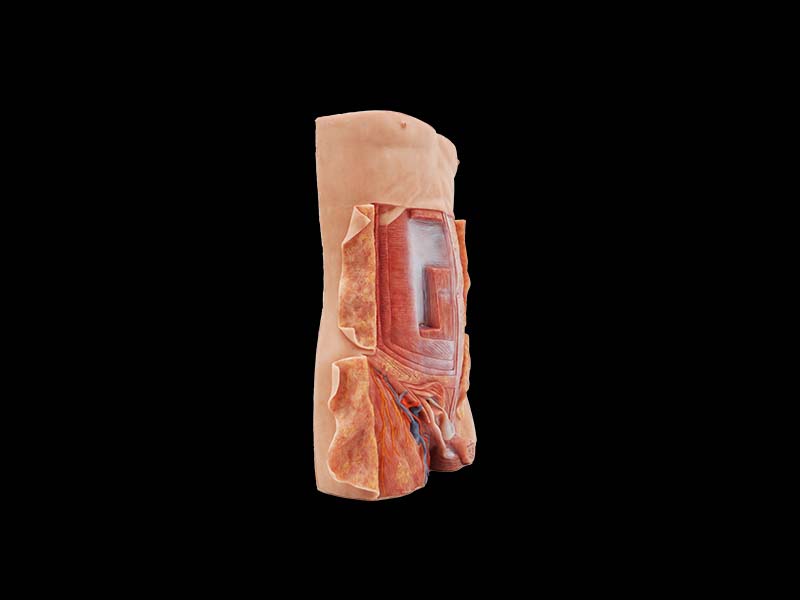 Anterior Abdominal Wall and Inguinal Hernia Silicone Anatomy Model