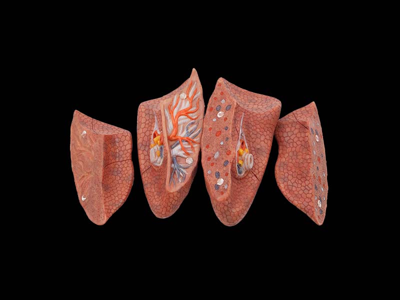 High Simulation Lung Anatomy Model for Sale