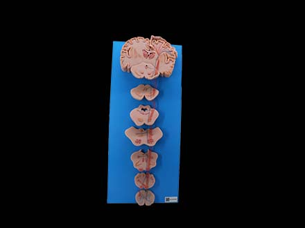 Conduction Bundle of Vertebral System Model