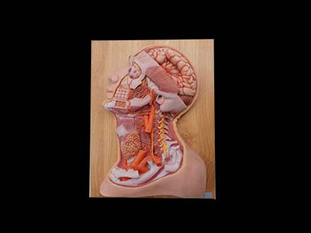 Deep Arteries and Nerves of Head and Neck Silicone Anatomy Model