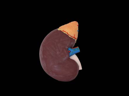 Enlarged Kidney Model