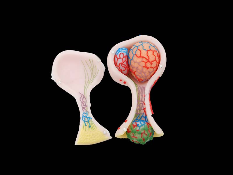 Enlarged pituitary gland silicone model