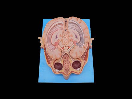 horizontal slice of eyeball through optic chiasma model