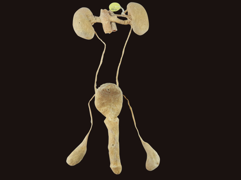 Male Urogenital System Plastinated Specimens Anatomical Specimens Human