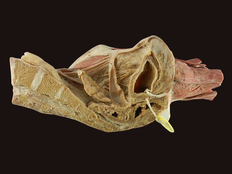 Sagittal Female Pelvis