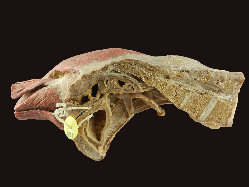 Sagittal Section Of Female Pelvis