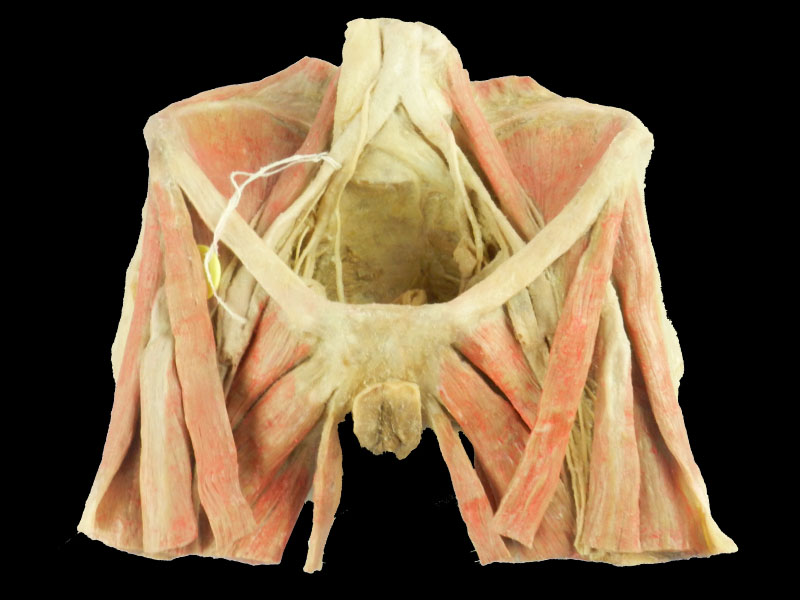 Female Perineal Muscle Plastinated Specimens Human Anatomy Model Hot