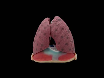 Left and Right Lungs Model