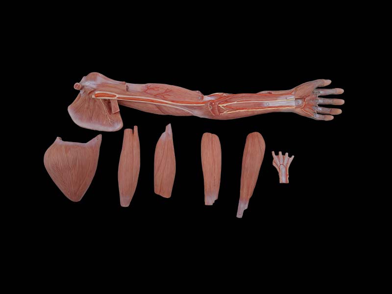 Silicone Muscles of Upper Limb Anatomy Model