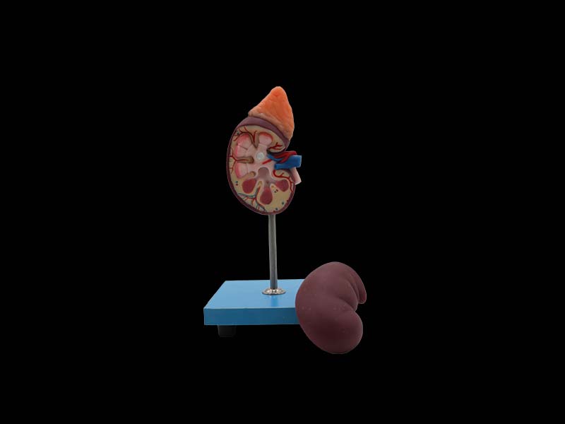 silicone kidney anatomy model