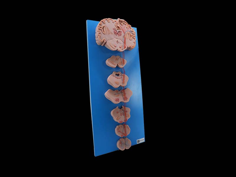 Simulated Conduction Bundle of Vertebral System Model