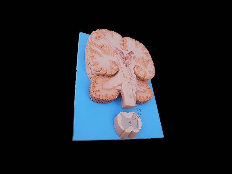 Simulated Conduction Bundle of Vertebral System Anatomy Model