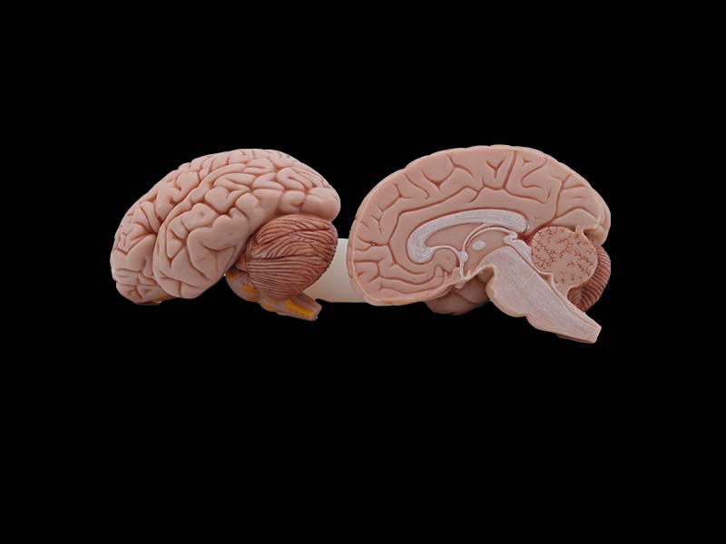 soft brain model