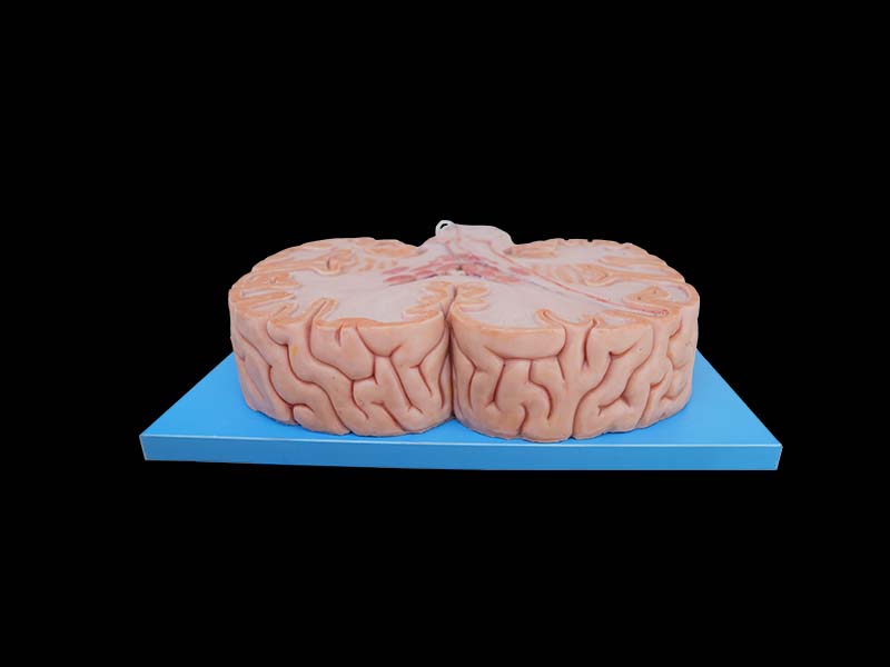 Soft Conduction Bundle of Vertebral System Anatomy Model