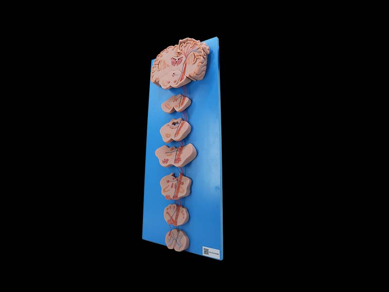 Soft Conduction Bundle of Vertebral System Model