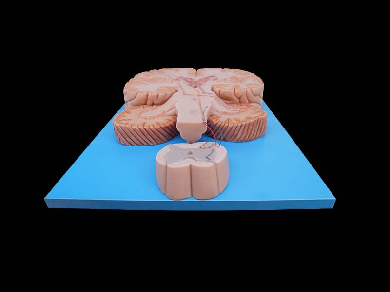 Soft Conduction Bundle of Vertebral System Model