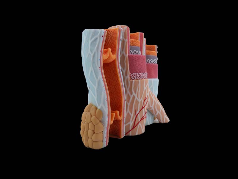 Soft Enlarged Artery and Vein Anatomy Model