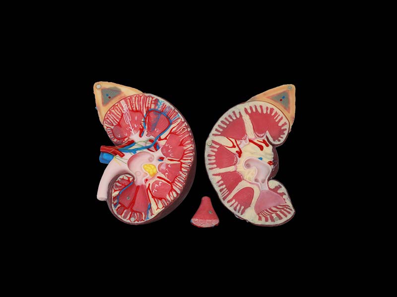 Soft Enlarged Kidney Anatomy Model