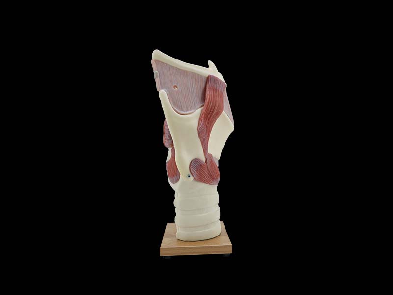 Soft Enlarged Larynx Model