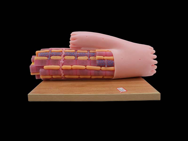 Soft Enlarged Myocardial Fiber Model