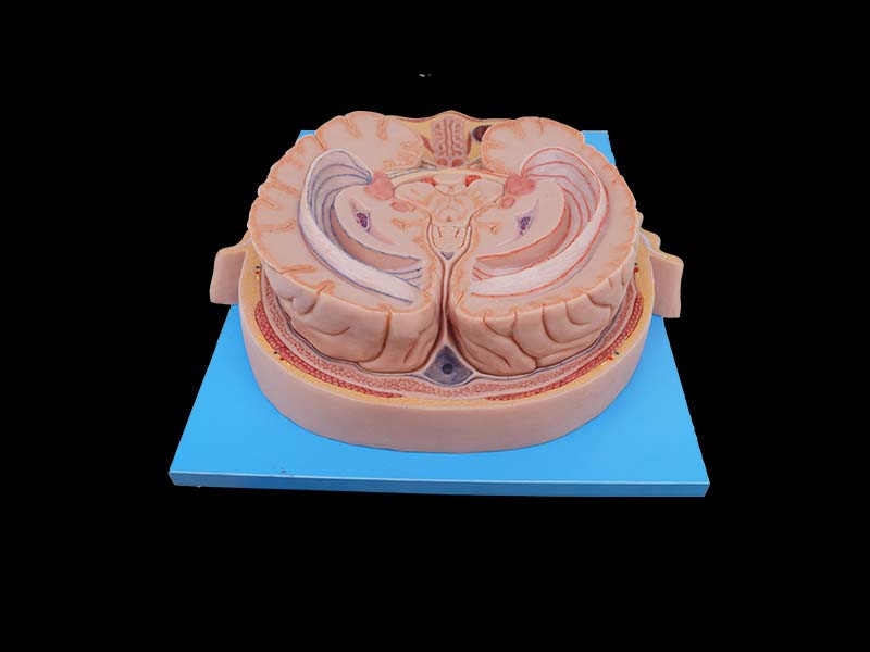 Silicone Horizontal Section of Eyeball Through Optic Chiasma Model