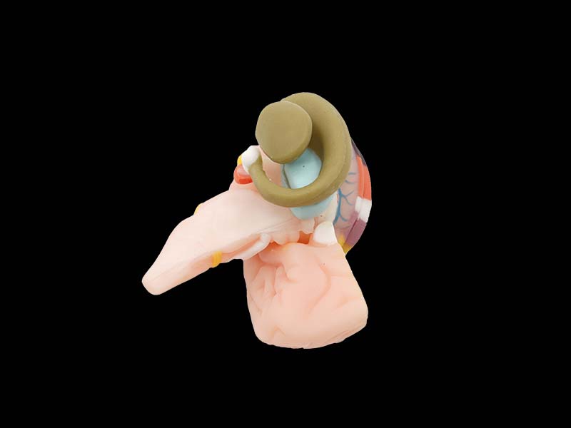 Soft Internal Capsule and Basal Nerve silicone Model