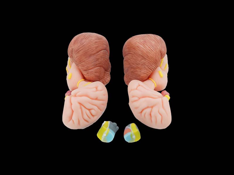 Soft Silicone Brainstem, Diencephalon, Thalamic Nucleus, Cerebellum and Fourth Ventricle Model