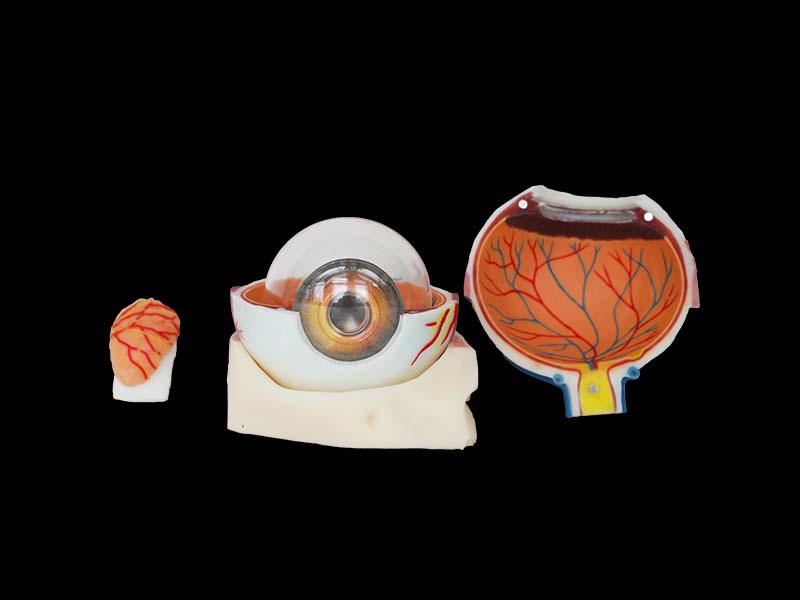  Soft Silicone Enlarged Eyeball Anatomy Model