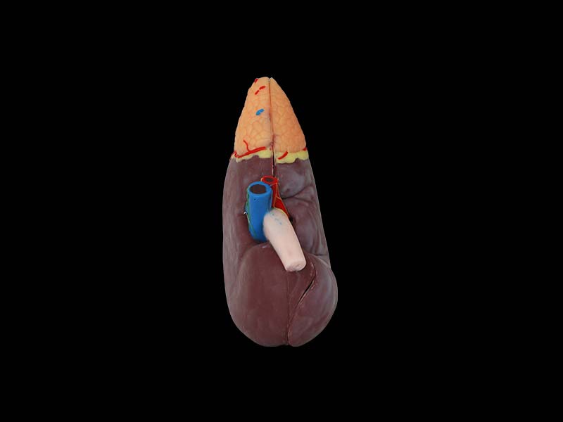 Soft Silicone Enlarged Kidney Model