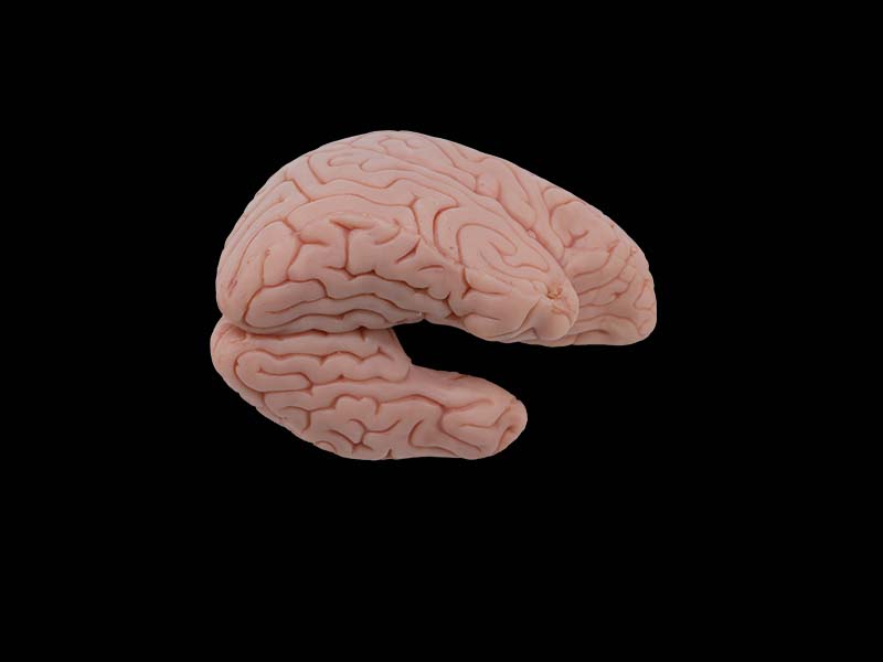 Soft Silicone Hippocampus and Fornix Model