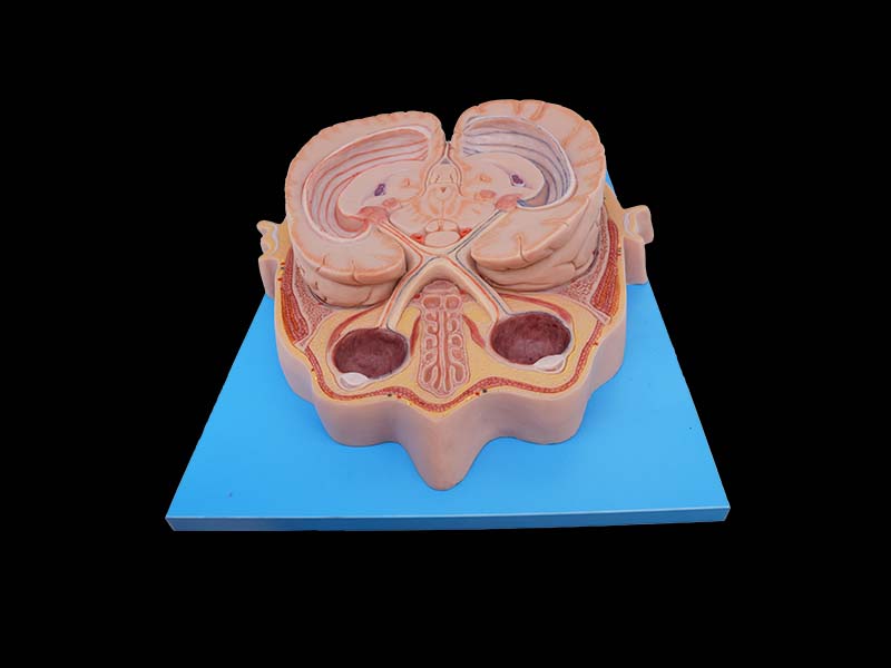 Soft Horizontal Section of Eyeball Through Optic Chiasma Model