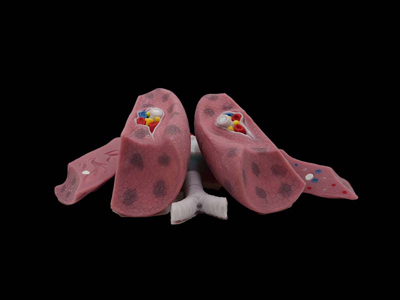 Soft Silicone Left and Right Lungs Anatomy Model