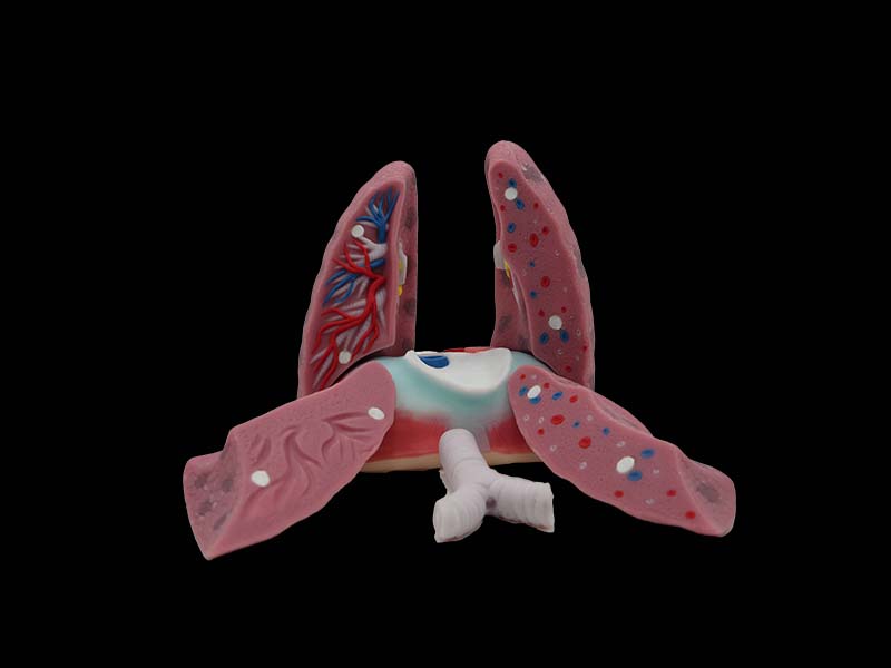 Soft Silicone Left and Right Lungs Model