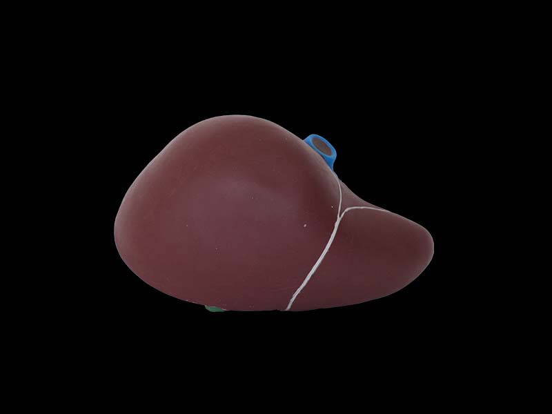 Soft Silicone Liver and Gallbladder Model