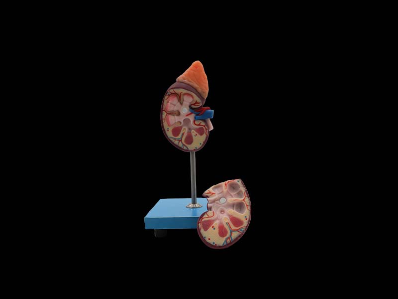 soft silicone kidney anatomy model