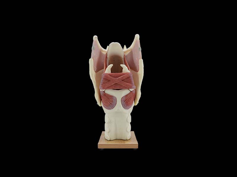 Soft Simulated Enlarged Larynx Anatomy Model