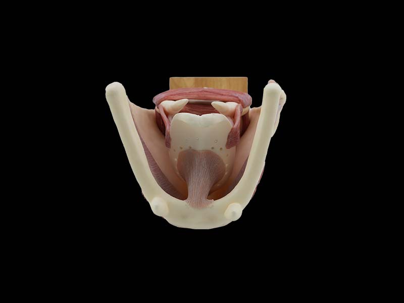 Soft Simulated Enlarged Larynx Model