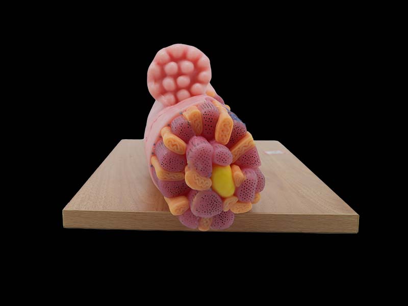 Soft Simulated Enlarged Myocardial Fiber Anatomy Model