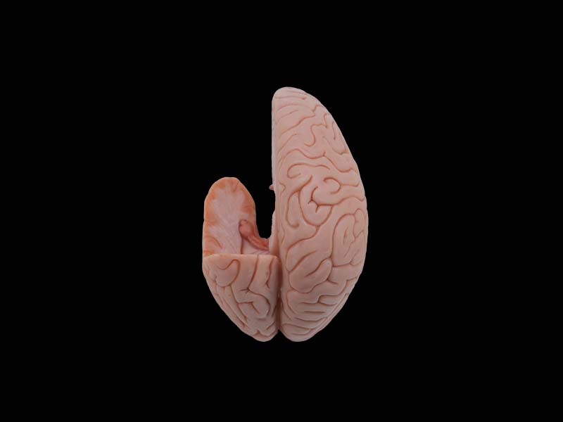 Soft Simulated Hippocampus and Fornix Anatomy Model