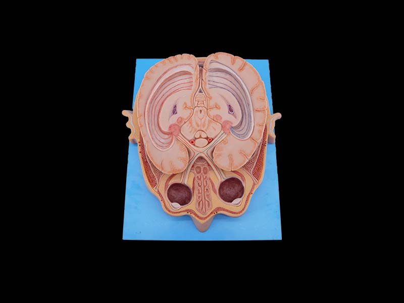 Soft Silicone Horizontal Section of Eyeball Through Optic Chiasma Model