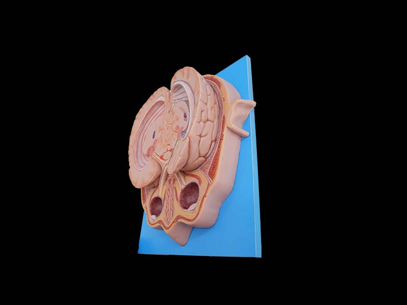 Soft Simulated Horizontal Section of Eyeball Through Optic Chiasma Model