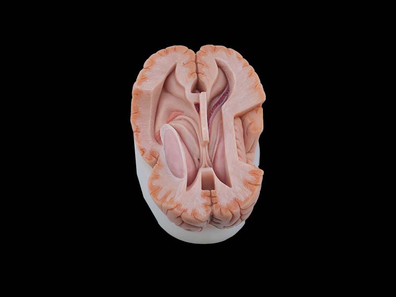 Soft Simulated Ventricle Anatomy Model