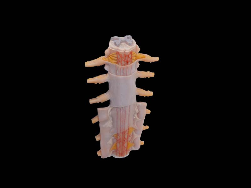 Soft Tunica of Spinal Cord Anatomy Model