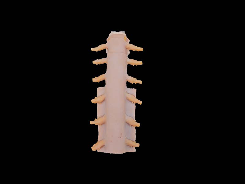 Soft Tunica of Spinal Cord Model