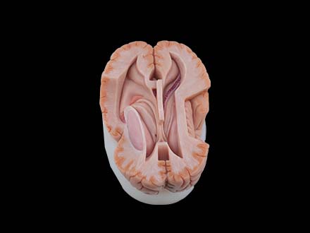 Ventricle Anatomy Model